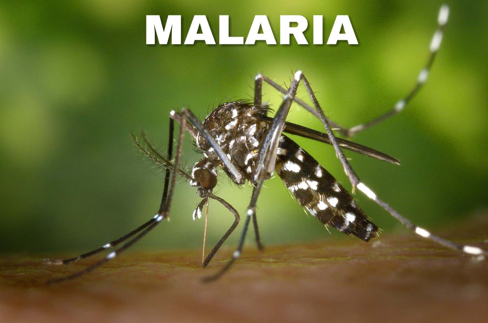 Malaria