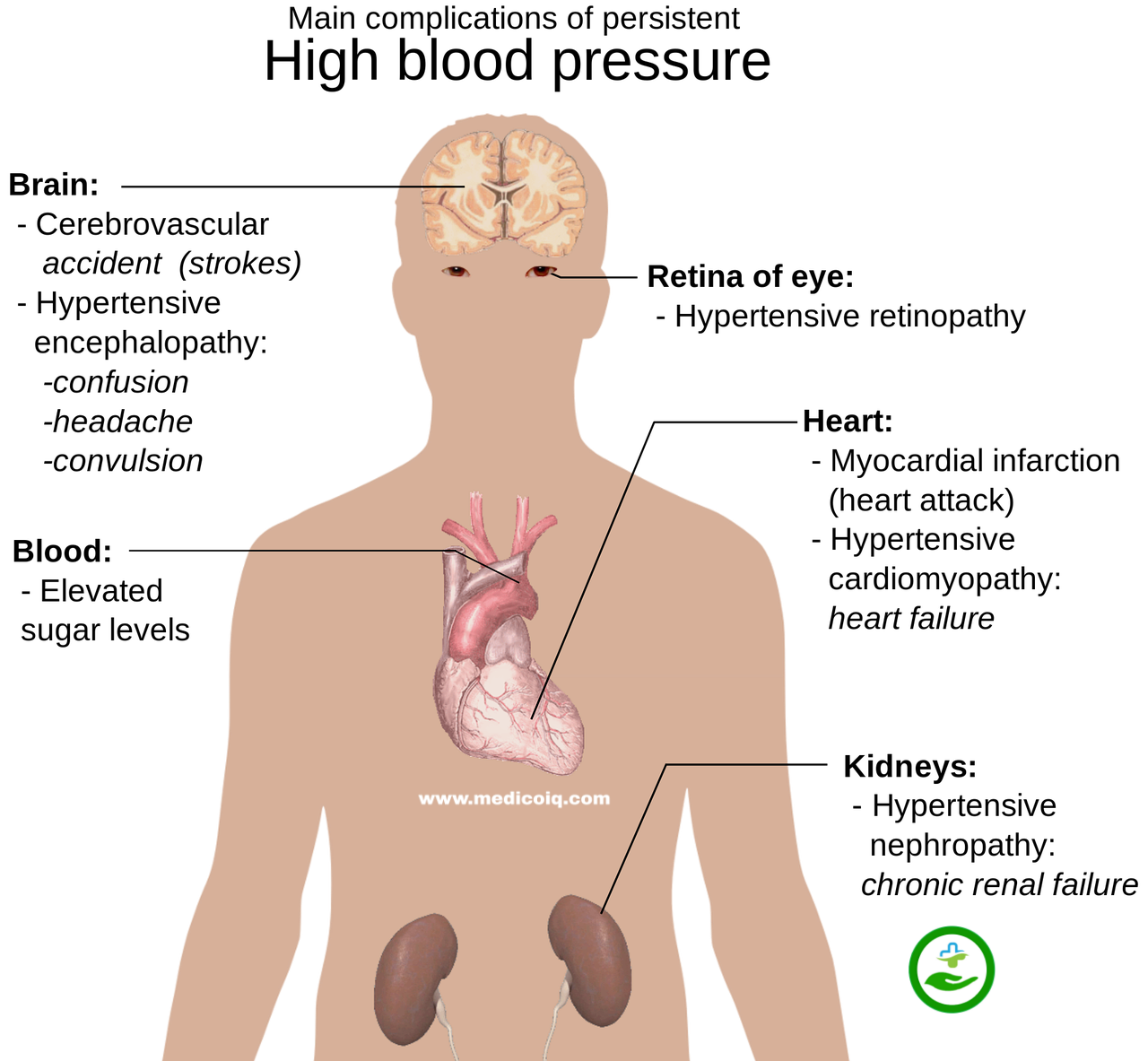 Hypertension Complications