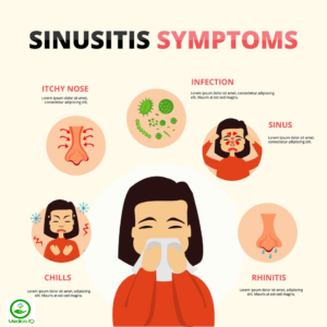 Sinusitis Causes, Symptoms & Treatment ( Sinus Infection )