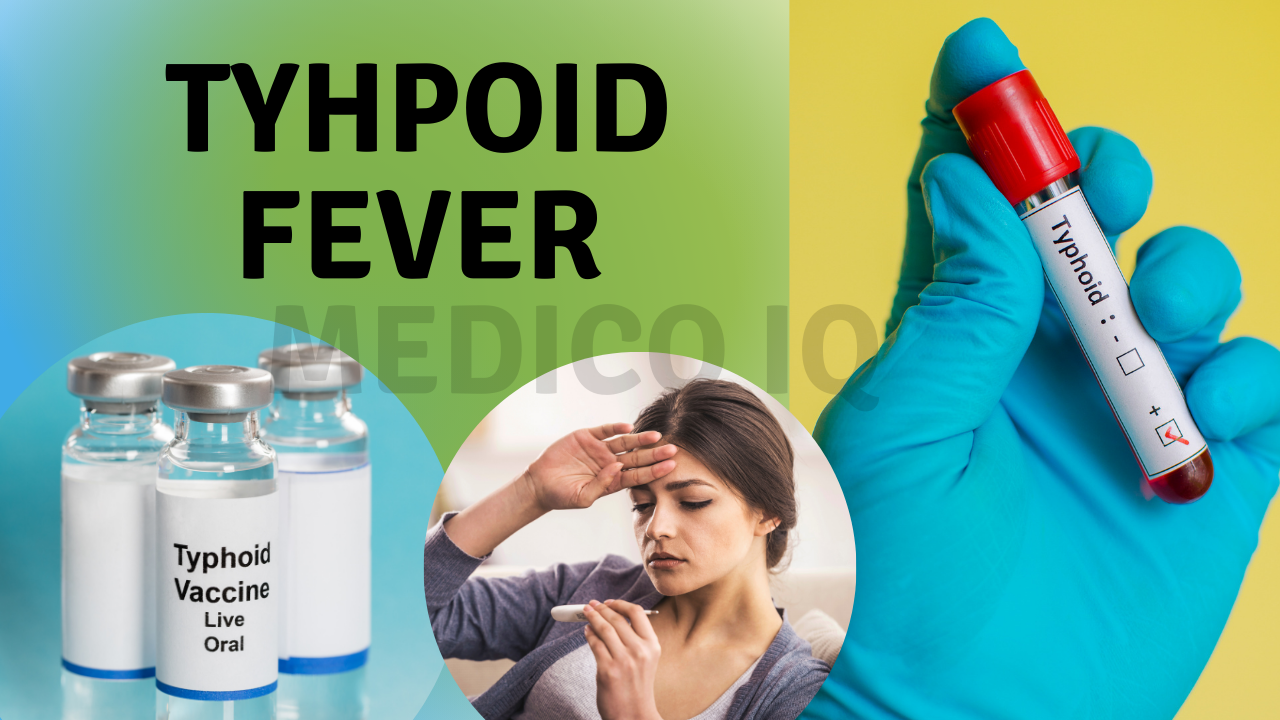 You are currently viewing Typhoid Fever-Causes,Symptoms,Treatment,Vaccines