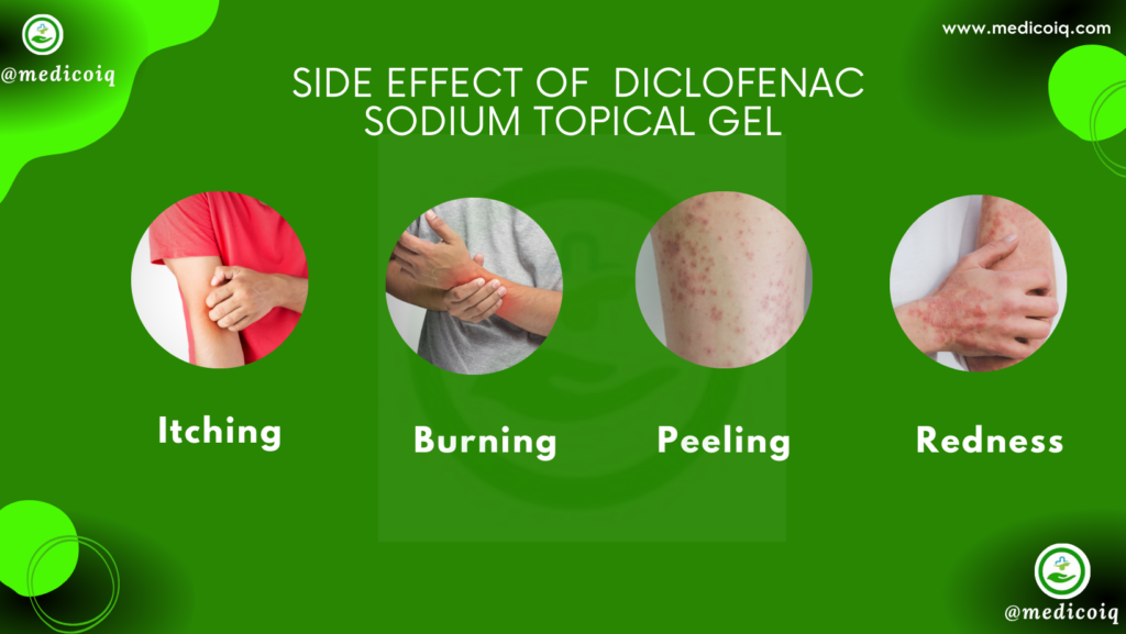 What Is Diclofenac Sodium Topical Gel Used For