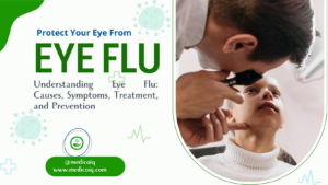 Read more about the article Understanding Eye Flu: Causes, Symptoms, Treatment, and Prevention
