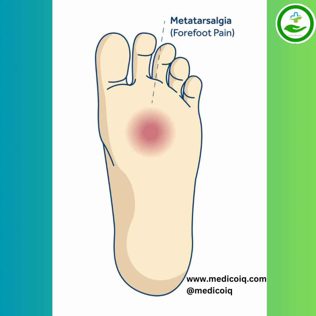 Metatarsalgia Understanding Foot Pain: An Essential Guide to Foot Pain Chart