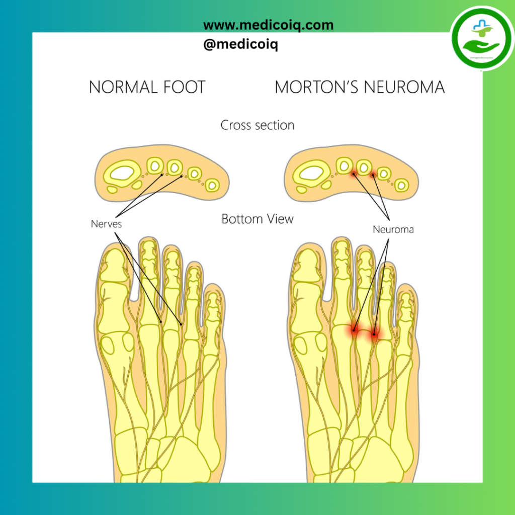 Understanding Foot Pain: An Essential Guide to Foot Pain Chart