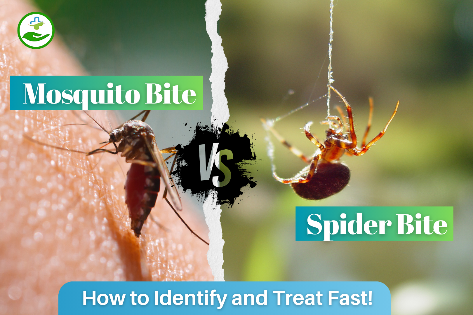 You are currently viewing Mosquito Bite vs Spider Bite: How to Identify and Treat Fast!