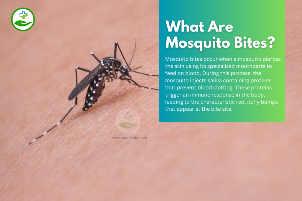 What Are Mosquito Bites