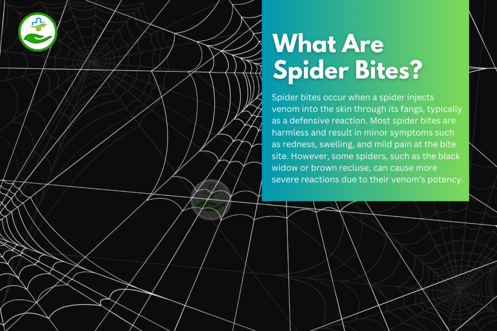 What Are Spider Bites