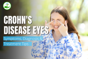 Read more about the article Crohn’s Disease Eyes: Symptoms, Diagnosis & Treatment Tips