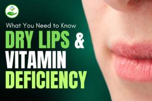 Read more about the article Dry Lips and Vitamin Deficiency: What You Need to Know