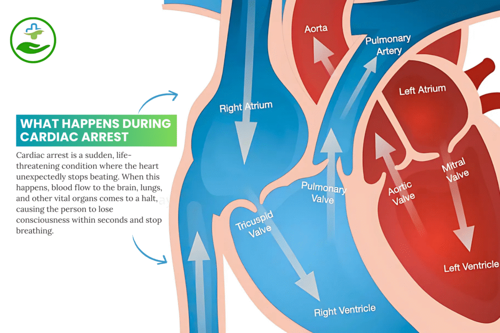 What Happens During Cardiac Arrest