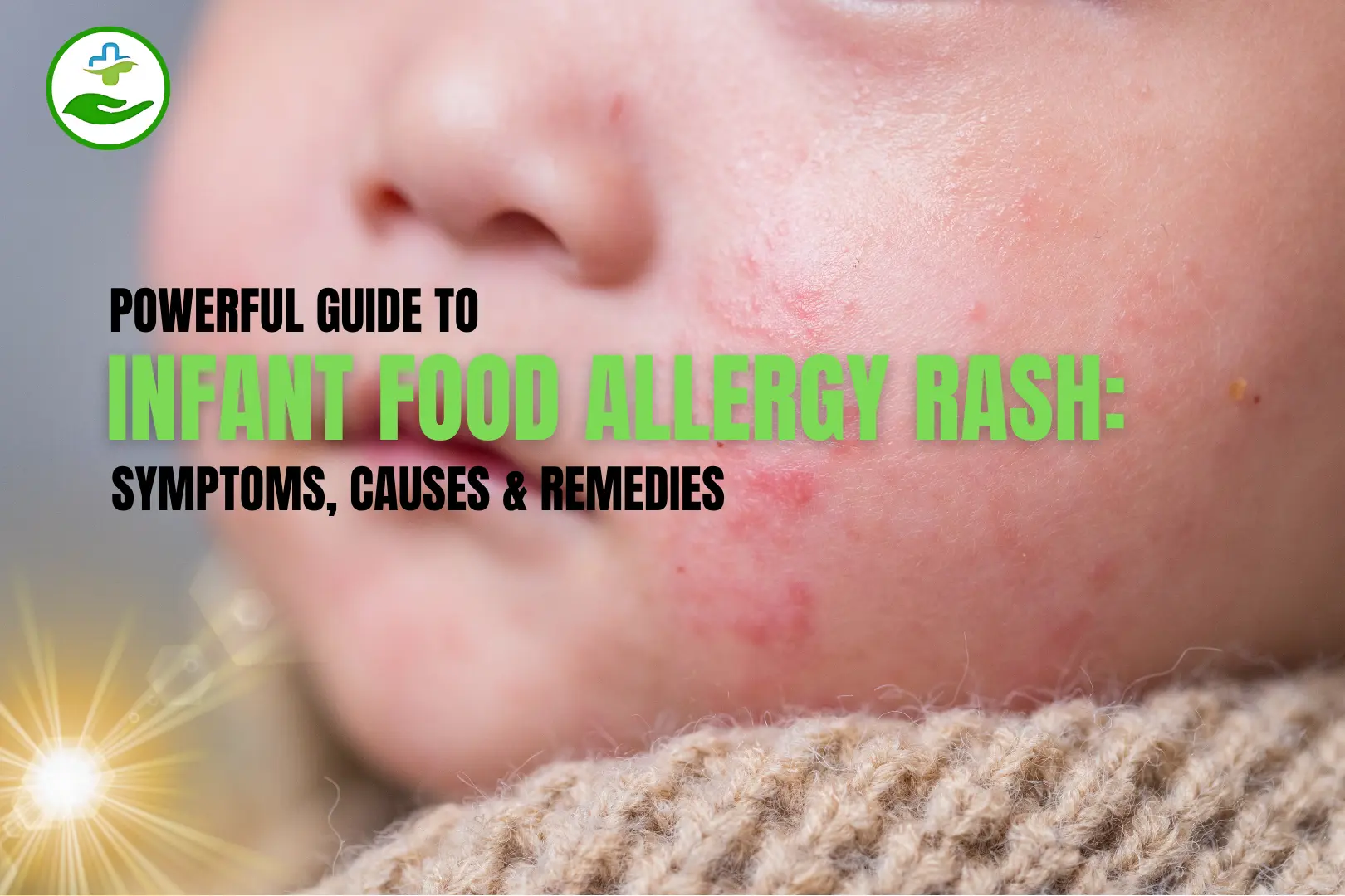 Read more about the article Powerful Guide to Infant Food Allergy Rash: Symptoms, Causes & Remedies