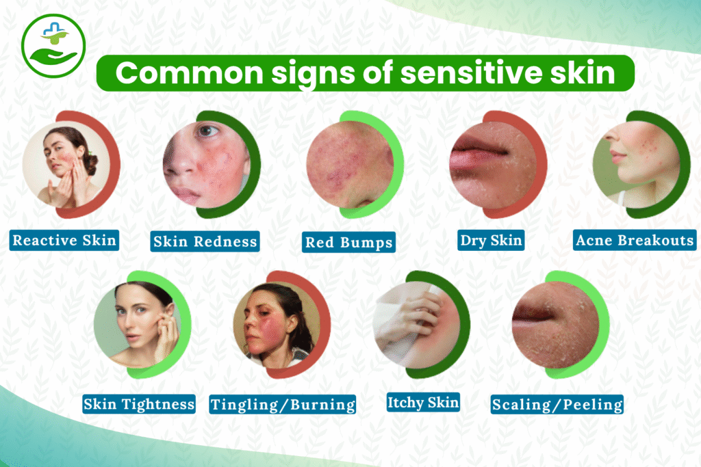 Common signs of sensitive skin
