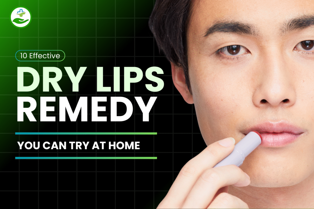 dry-lips-remedy