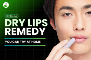 Read more about the article 10 Effective Dry Lips Remedy You Can Try at Home