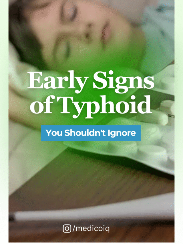 Early Signs of Typhoid You Shouldn’t Ignore