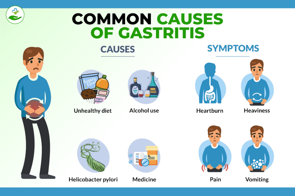 Can Gastritis Cause Back Pain