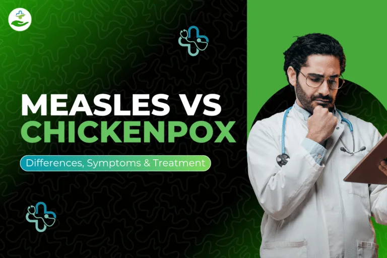 Measles vs Chickenpox