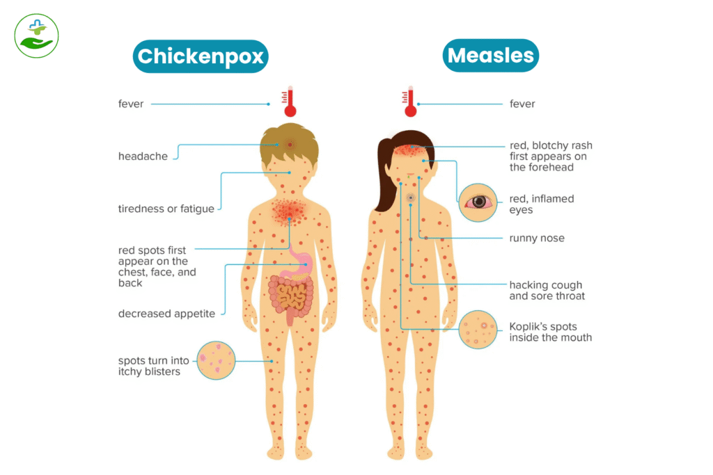 Symptoms Comparison Chart