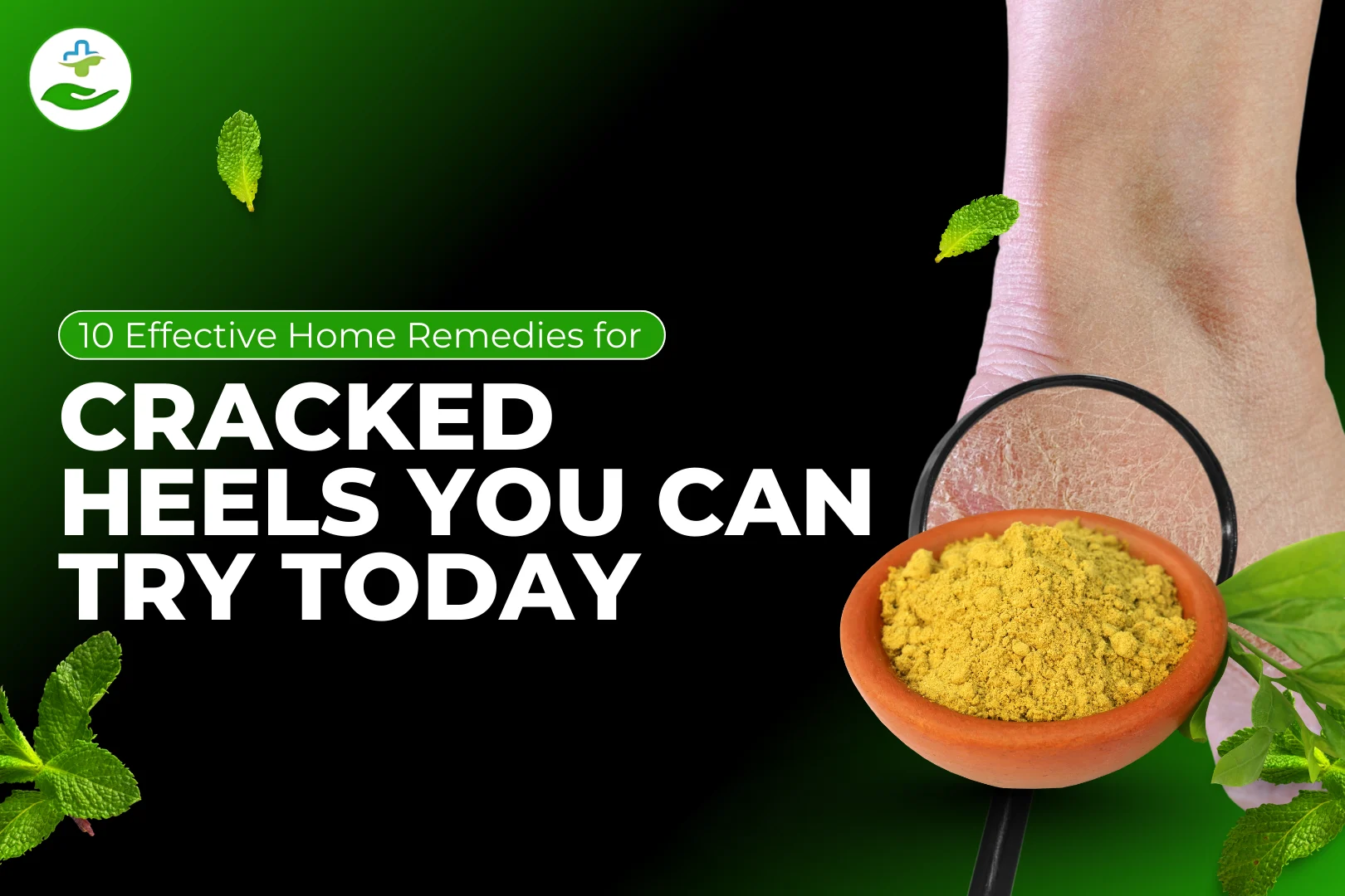 You are currently viewing 10 Effective Home Remedies for Cracked Heels You Can Try Today