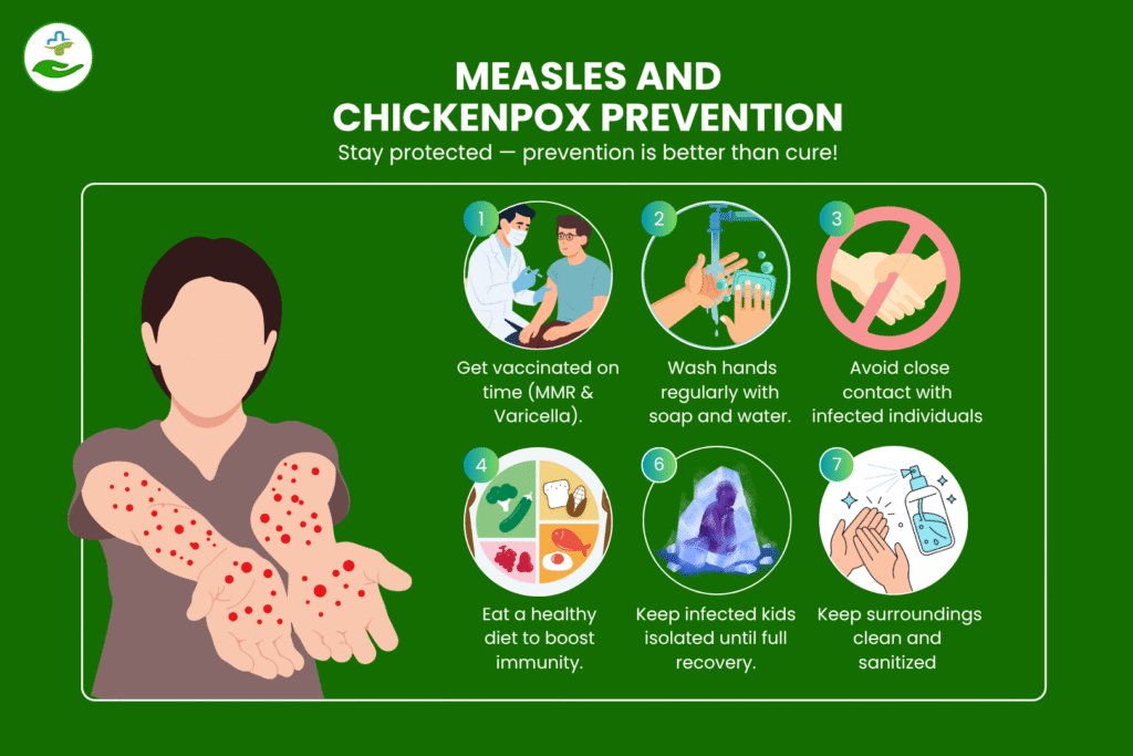 measles and chickenpox Prevention