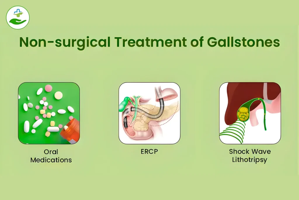 What Foods Cause Gallstones? 10 Risky Picks Non-surgical Treatment of Gallstones