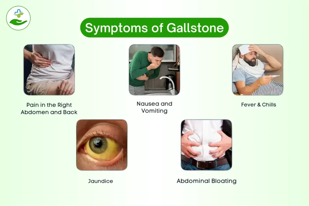 What Foods Cause Gallstones? 10 Risky Picks What Foods Cause Gallstones